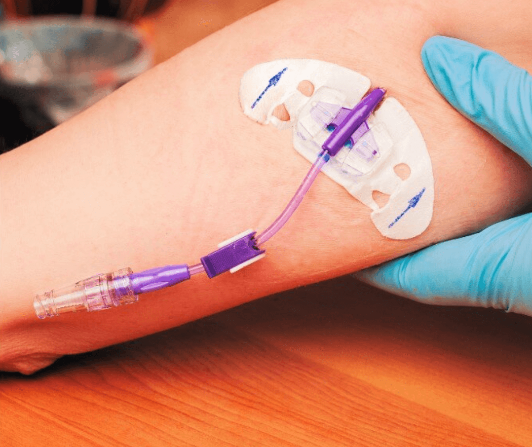 top-5-uses-for-picc-lines-and-midlines-piccsox-picc-line-covers